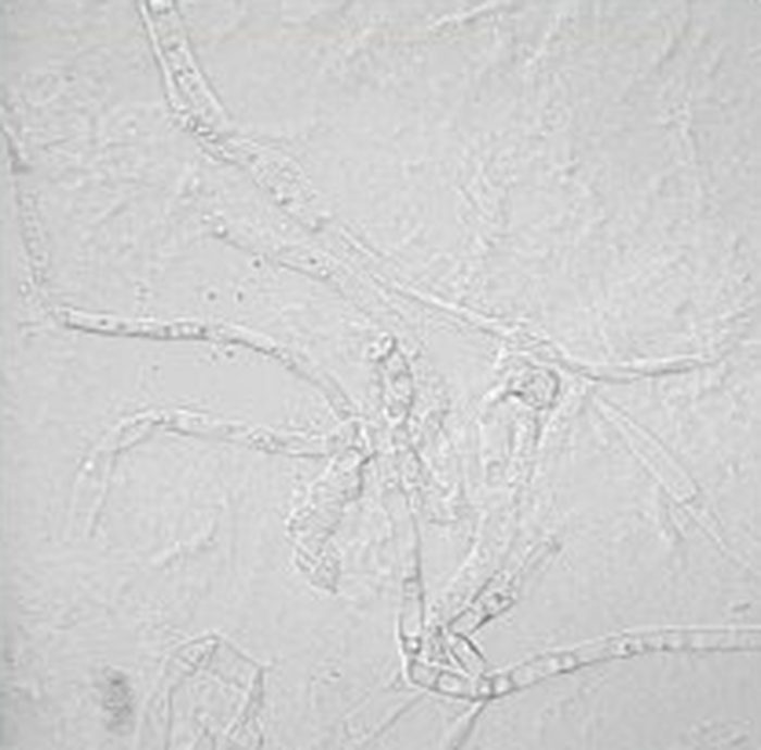 Brightfield confocal image — Trans. 8996
